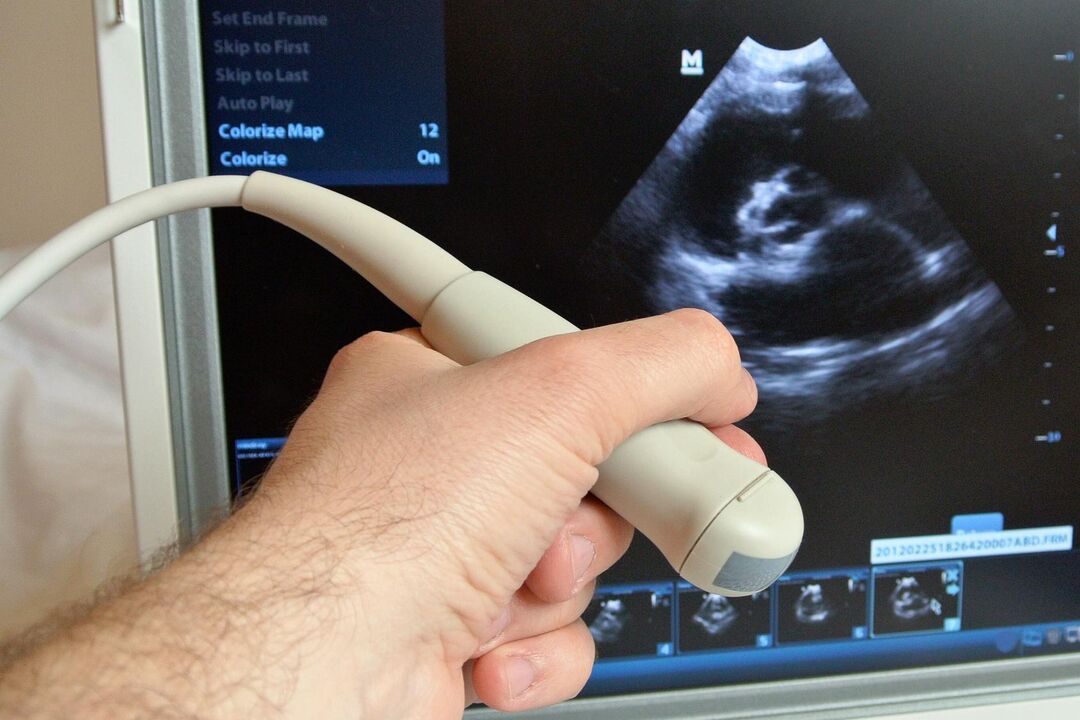 Ultrason bir erkekte konjestif prostatitin teşhisine yardımcı olacaktır